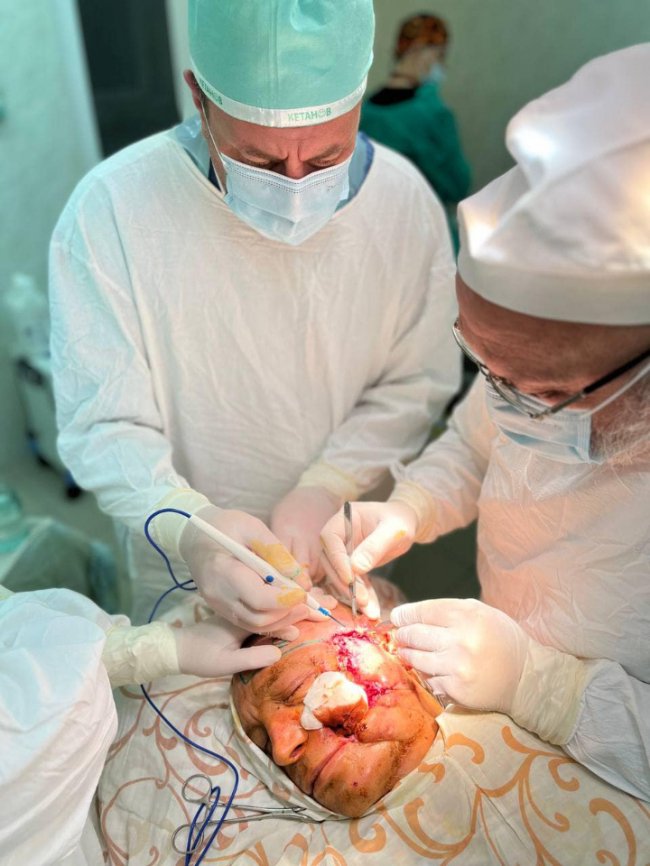 У Луцьку лікарі провели унікальну операцію на обличчі. ФОТО