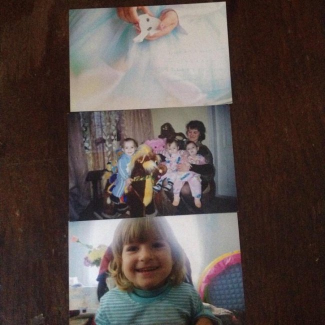 Маленькій волинянці необхідно 50 тисяч гривень на лікування. ФОТО