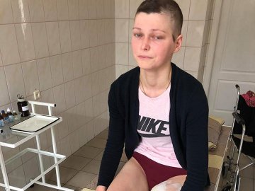 25-річній дівчині з Волині ампутували ногу з пухлиною: збирають гроші на протез