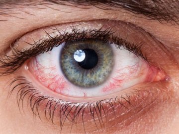 У волинській лікарні з ока чоловіка дістали 13-міліметрову дротинку 