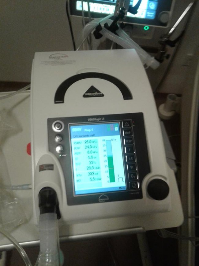 Настусі Абрамчук потрібна допомога, аби «звільнитись» від апарату дихання