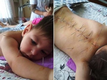 Маленькому волинянину потрібні кошти, щоб долікуватися в Китаї