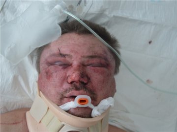 На Волині знайшли чоловіка у важкому стані, шукають родичів. ФОТО