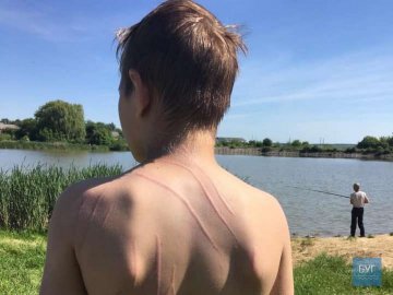 У волинському озері пес поплив за дитиною і напав на неї