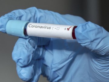 В Україні запустять онлайн-карту про ситуацію в лікарнях щодо коронавірусу