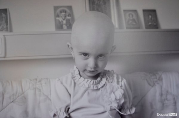 У Луцьку - виставка світлин про рак у дітей. ФОТО