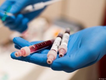 Антитіла до СOVID-19 можуть жити 8 місяців - вчені