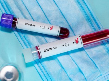 За добу – 27 хворих: де на Волині виявили нові випадки коронавірусу станом на ранок 1 травня