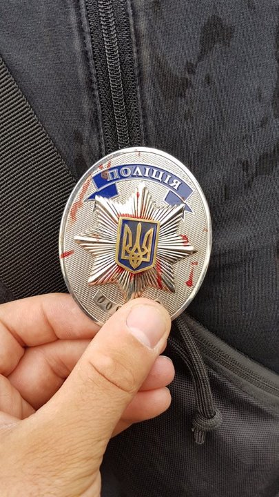 Лучанин постраждав під час протистояння з копачами бурштину