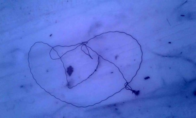 На Волині козуля потрапила у пастку браконьєрів. ФОТО