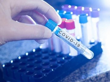 На Волині за минулу добу на коронавірус захворіли 3 людей, а 11 одужали
