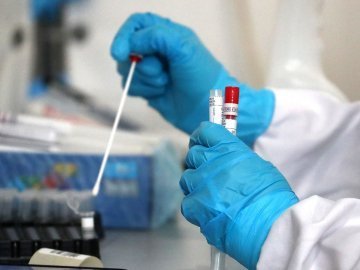 Повідомили статистику щодо COVID-19 в Україні за минулу добу