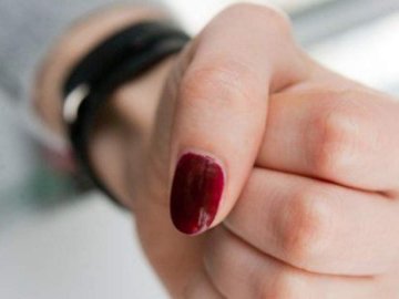 На Волині жінка напала на 12-річну дівчинку і побила її