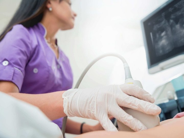 Що таке УЗД та коли його призначають: простою мовою про важливу діагностику