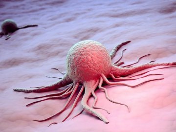 Кожен 46-ий волинянин – хворіє на рак. ВІДЕО