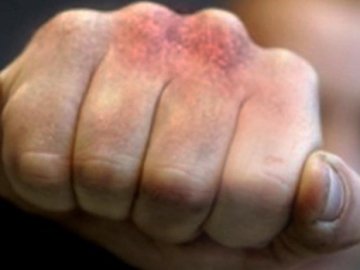 Двоє молодиків побили 19-річного волинянина