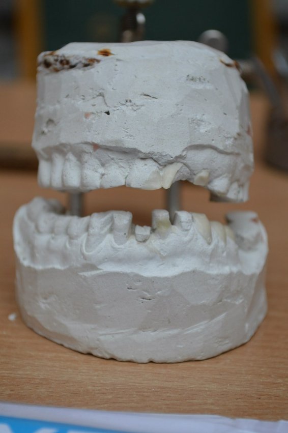 На Прикарпатті гурт грає на стоматологічних інструментах. ФОТО. ВІДЕО