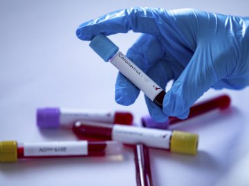 У родичів померлого 19-річного хлопця з Торчина не виявили коронавірусу