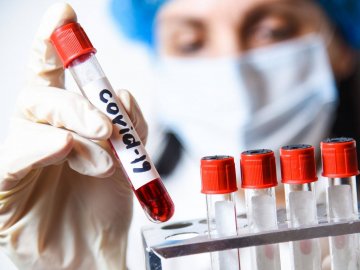 90% населення світу має імунітет до коронавірусу 