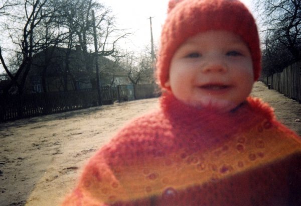 Маленькій волинянці потрібна допомога. ФОТО