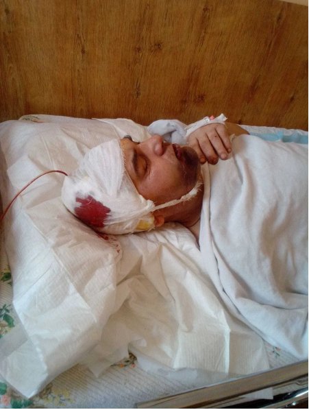 Бив берцями по голові і залишив стікати кров'ю: на Волині офіцер познущався над підлеглим. ФОТО