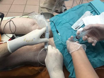 У луцькій лікарні запровадили новий метод анестезії, який допомагає пацієнту швидше одужати