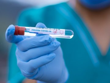 В Україні  – 2 495 нових випадків коронавірусу,  з них на Волині – 66