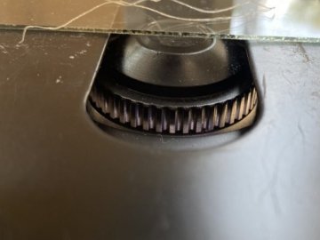 У 33-річної волинянки з повіки видалили 11-сантиметрового гельмінта