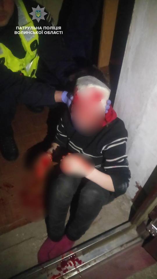 Волинські патрульні врятували жінку з проламаною головою. ФОТО. ВІДЕО