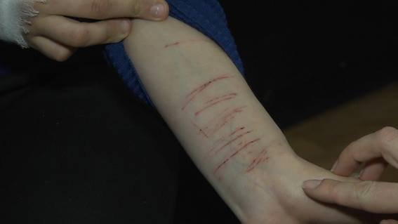 У Києві врятували двох підлітків від смертельної гри  «Синій кит»