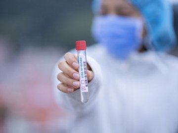 Повідомили статистику щодо коронавірусу на Волині за минулу добу