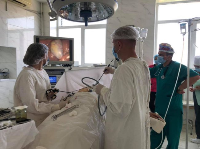 Волинський лікар видалив чималий камінь із жовчного пацієнта без розрізів 