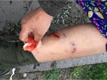 У Нововолинську пес покусав літню жінку. ФОТО