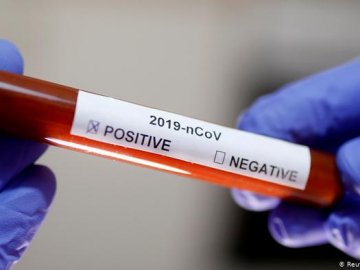 В Україні зафіксували 47 випадків коронавірусної хвороби