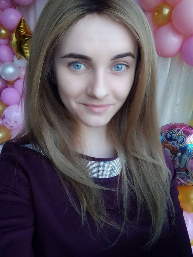 «Я втомилася ховати свою хворобу та змогла полюбити себе»: історія дівчини з Волині, яка з дитинства має важку недугу  