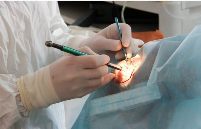 У волинській лікарні за добу 35 людям врятували зір. ФОТО