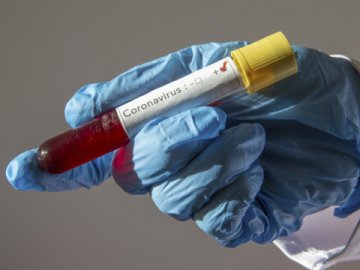 В Україні – 5 449 випадків коронавірусу, 150 з них – на Волині 