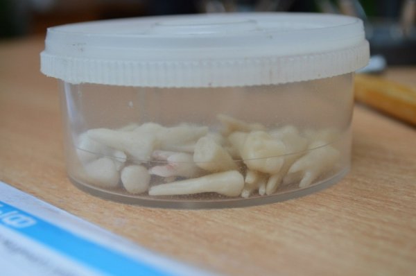 На Прикарпатті гурт грає на стоматологічних інструментах. ФОТО. ВІДЕО