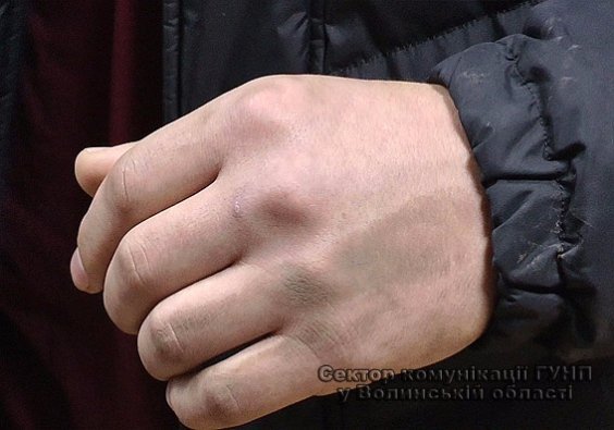 Луцькі поліцейські з’ясовують обставини інциденту за участю громадського активіста. ФОТО