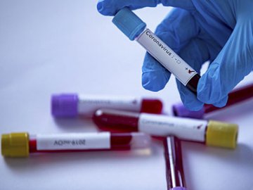 Новий антирекорд: в Україні за добу – 1 847 випадків коронавірусу, з них на Волині – 61