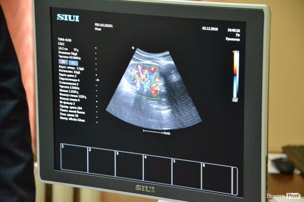 Мер Ковеля показав досягнення міста за рік