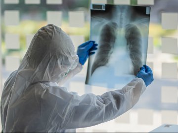 Найбільше за весь час: в Україні – 1109 нових випадків коронавірусу за останню добу, з них на Волині – 72