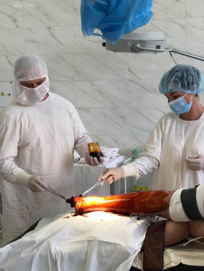 Клеїла шпалери і впала з табуретки: волинські лікарі врятували жінці ногу. ФОТО