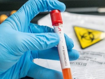 Одна смерть та 8 нових випадків за добу: де у Камінь-Каширському районі виявили коронавірус