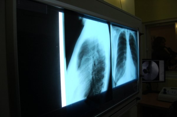 Стало відомо, що покажуть президенту в лікарні. ФОТО