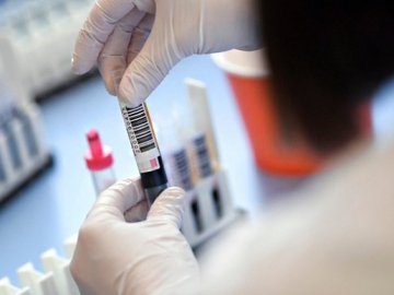 Повідомили, скільки заражених коронавірусом виявили в Україні за минулу добу