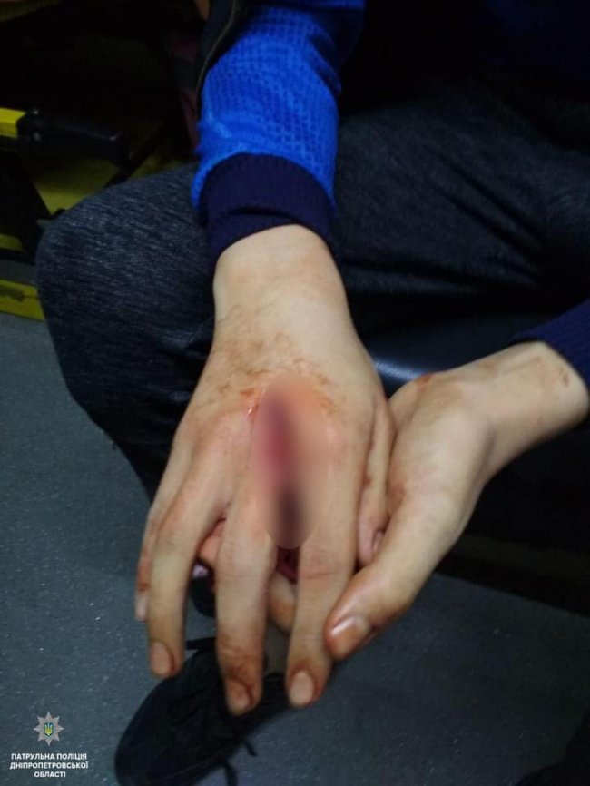 У Дніпрі чоловік з мачете взяв у заручники 3-річну дитину