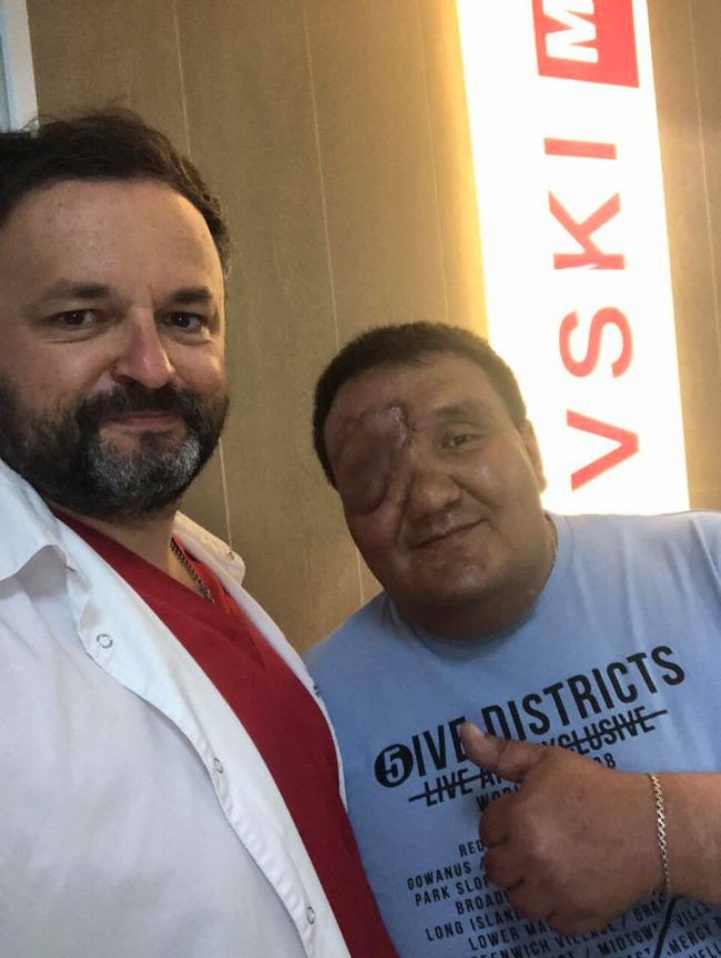Відомий хірург з Волині прооперував чоловіка з пухлиною на обличчі. ФОТО