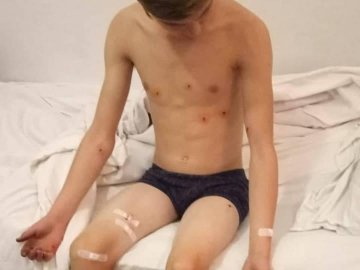 Чоловік посеред вулиці вистрілив у дітей з рушниці. ФОТО