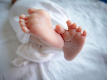 Двомісячна дівчинка померла від опіків після операції у Рівному 
